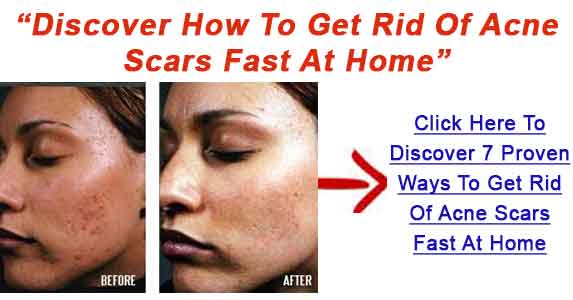 Get Rid Of Facial Scars 70
